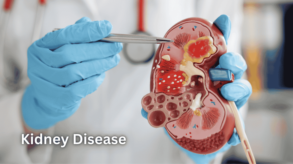 Kidney Kharab Hone Ke Lakshan in Hindi